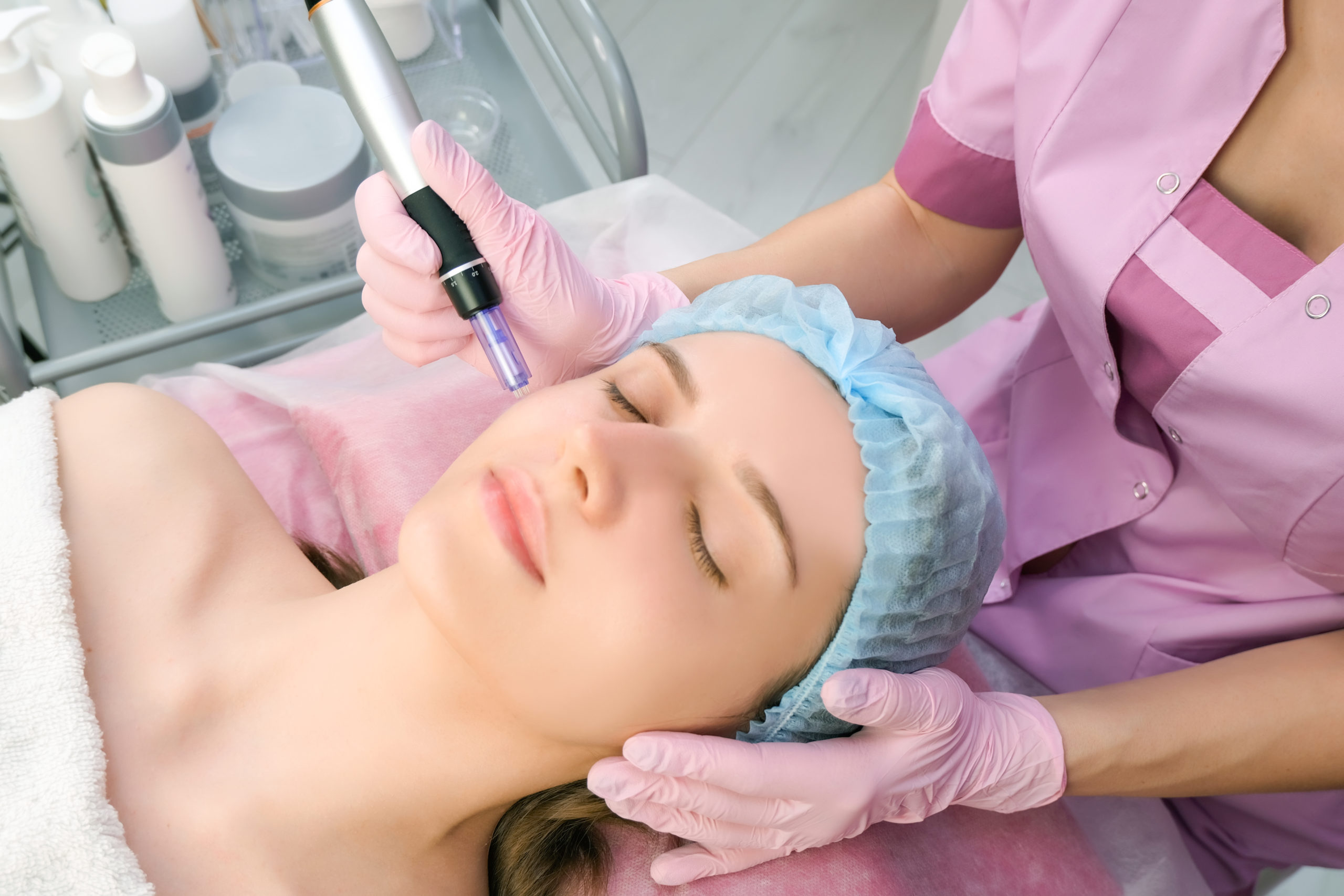 Should I invest in Microneedling?