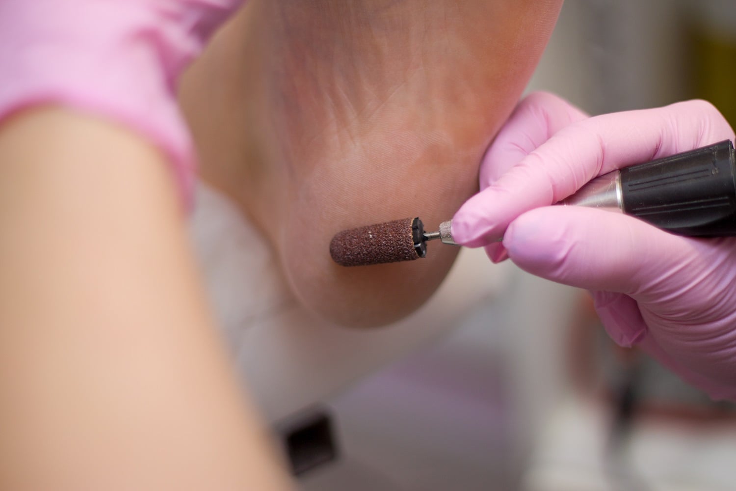 What is the best treatment for perfect, soft feet this winter?