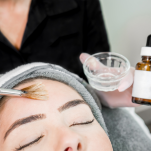 Online Skin Peel Course